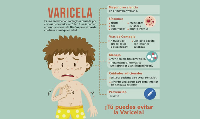 Precauciones para prevenir la varicela